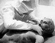 Alien Autopsy